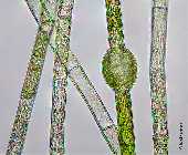 Oedogonium_Oogon.jpg