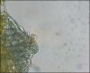 Ansiedlung Compsopogon 40x